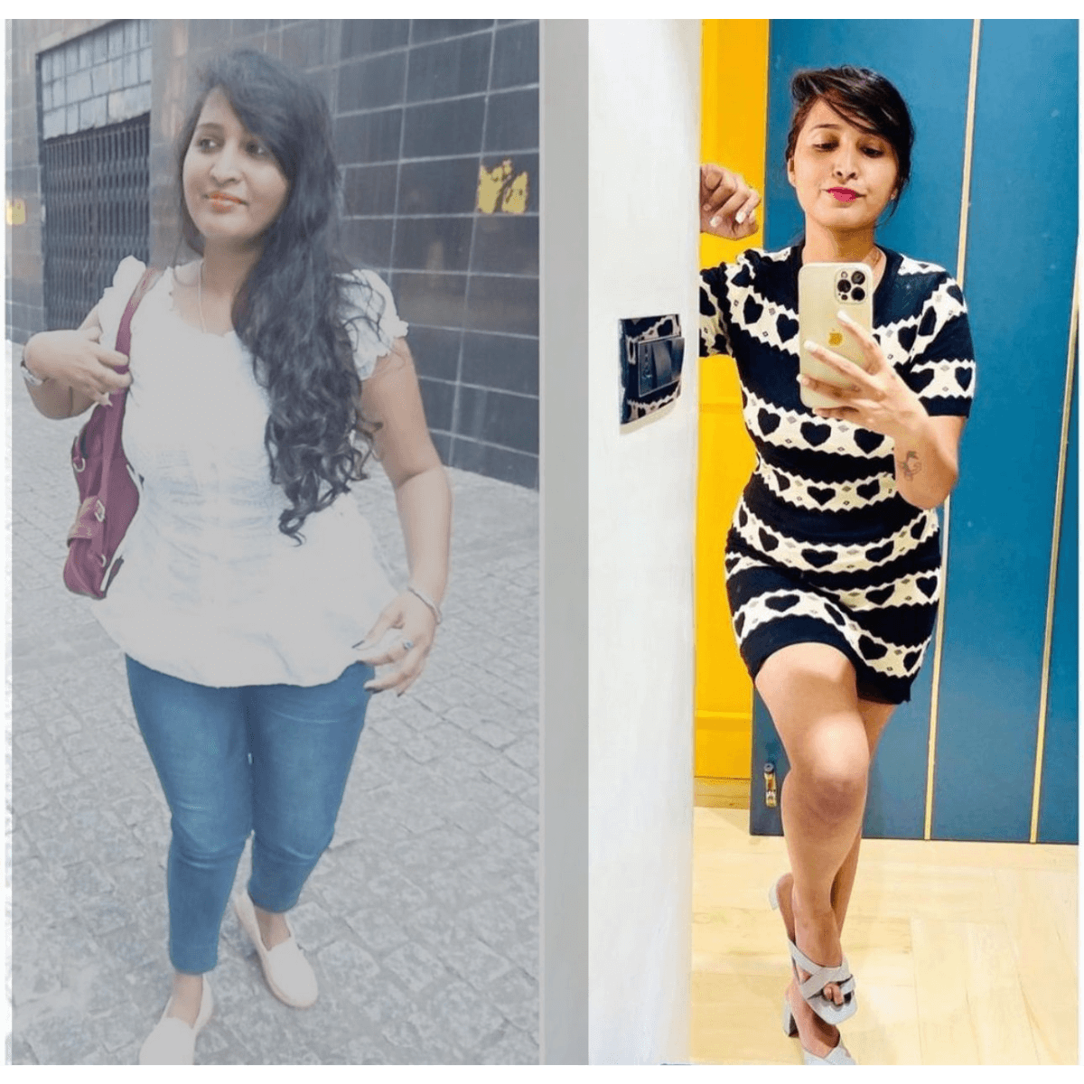 DrSnehalbeforeafter_e0mtq_1200