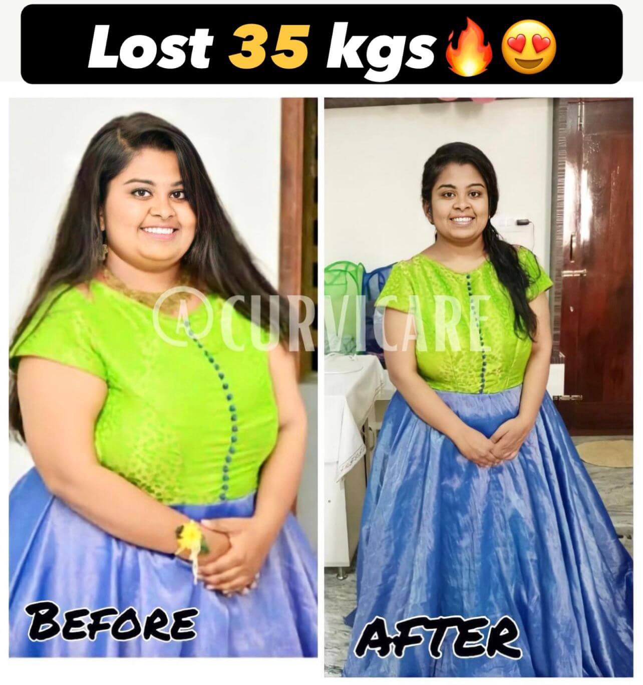 curvicaretransformation01_q5nzu_1284