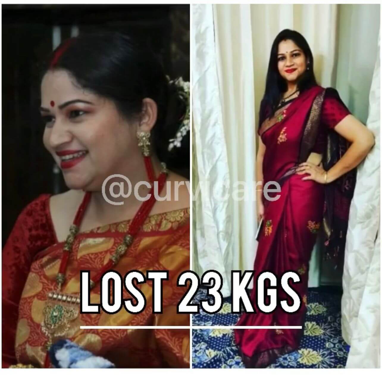 curvicaretransformation03_m5mdm_1284