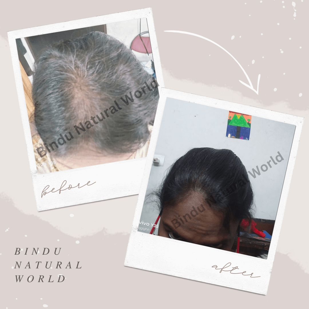 BinduNaturalWorldBeforeandAfter17_a0mtu_1080