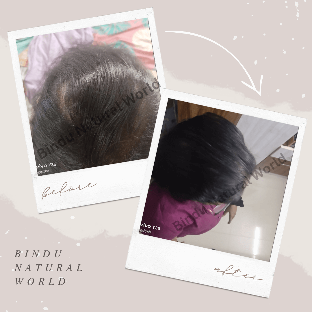 BinduNaturalWorldBeforeandAfter18_cwmdy_1080