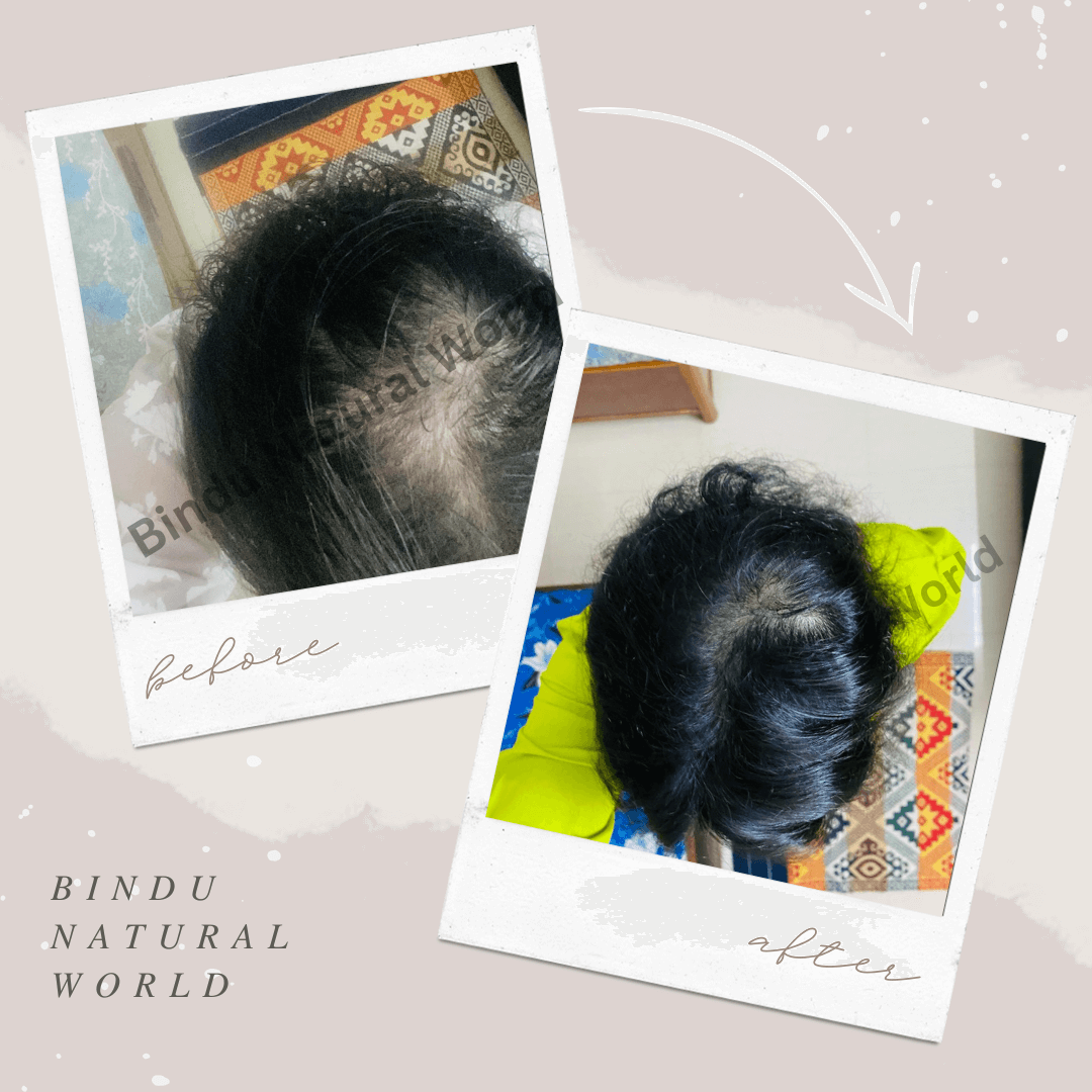 BinduNaturalWorldBeforeandAfter19_u2ndg_1080