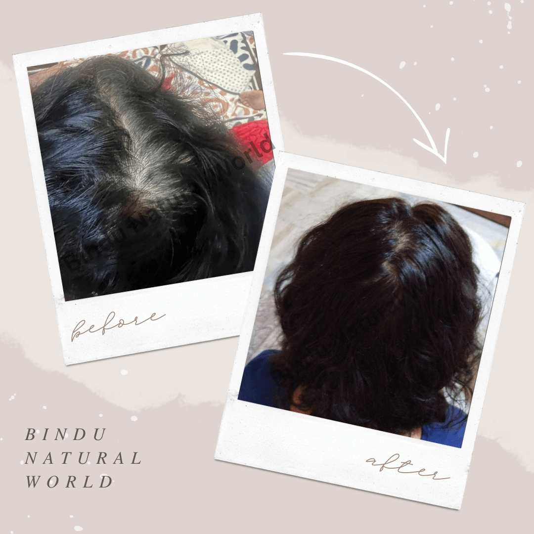 BinduNaturalWorldBeforeandAfter20_mwmdg_1080