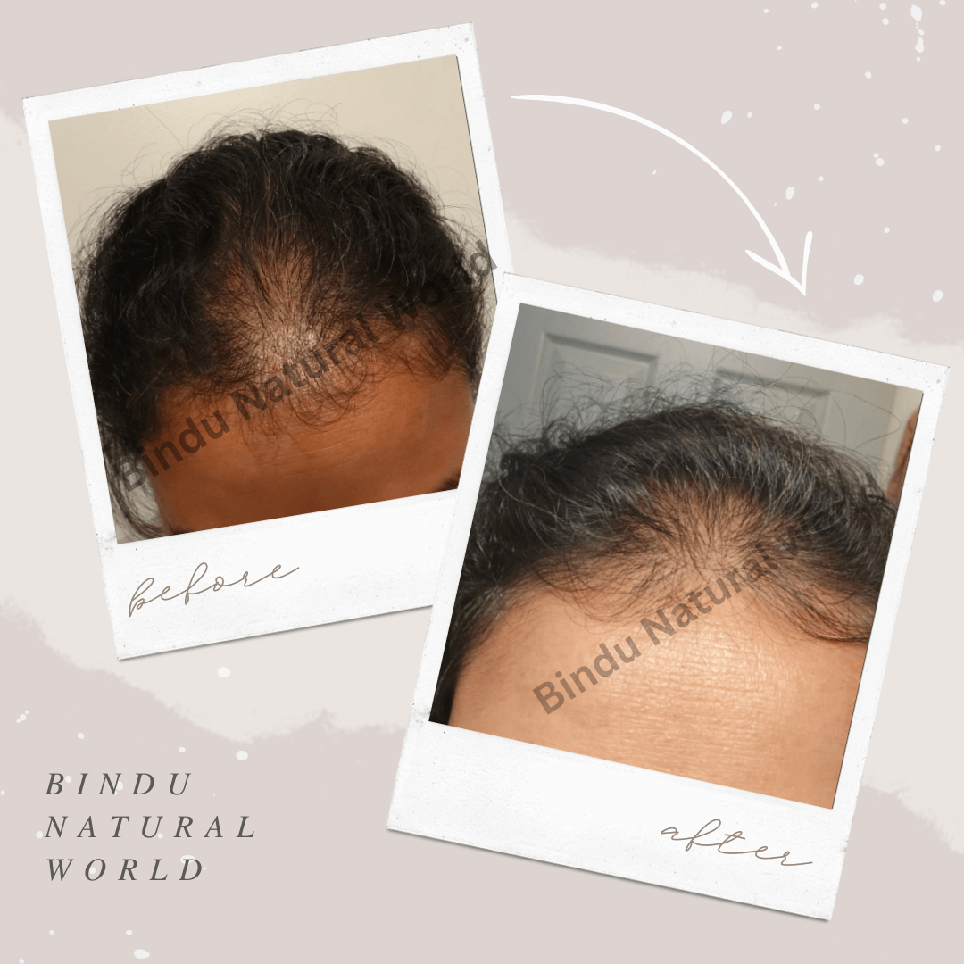 BinduNaturalWorldBeforeandAfter2_cwnju_1080