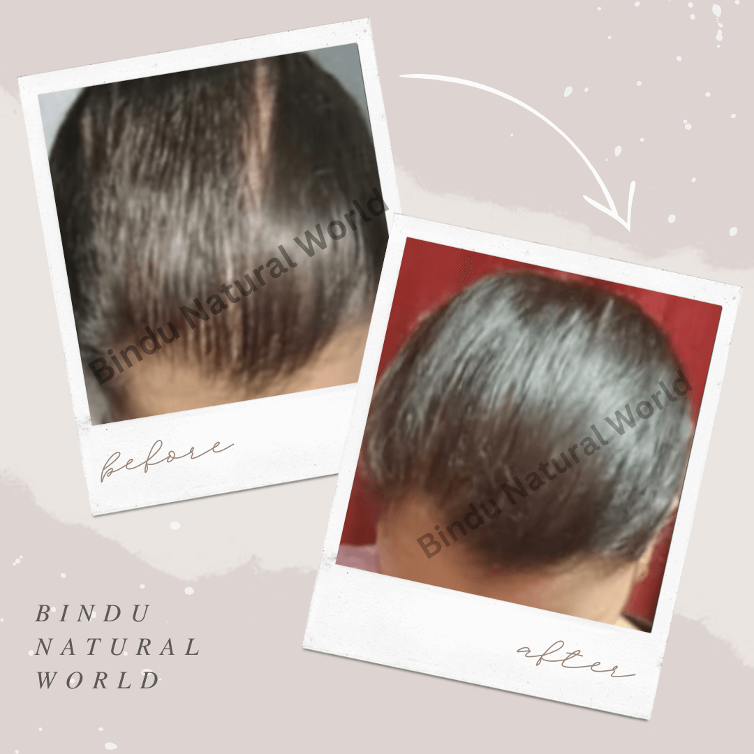 BinduNaturalWorldBeforeandAfter5_y1odc_1080