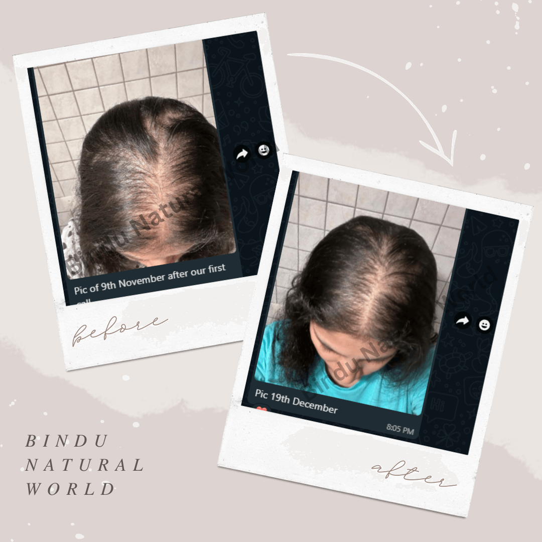 BinduNaturalWorldBeforeandAfter6_a1nza_1080