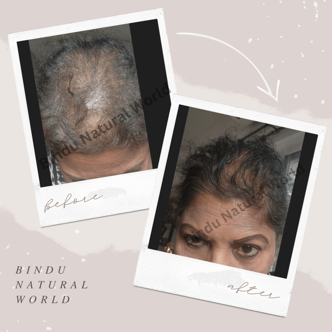 BinduNaturalWorldBeforeandAfter7_q1mdk_1080