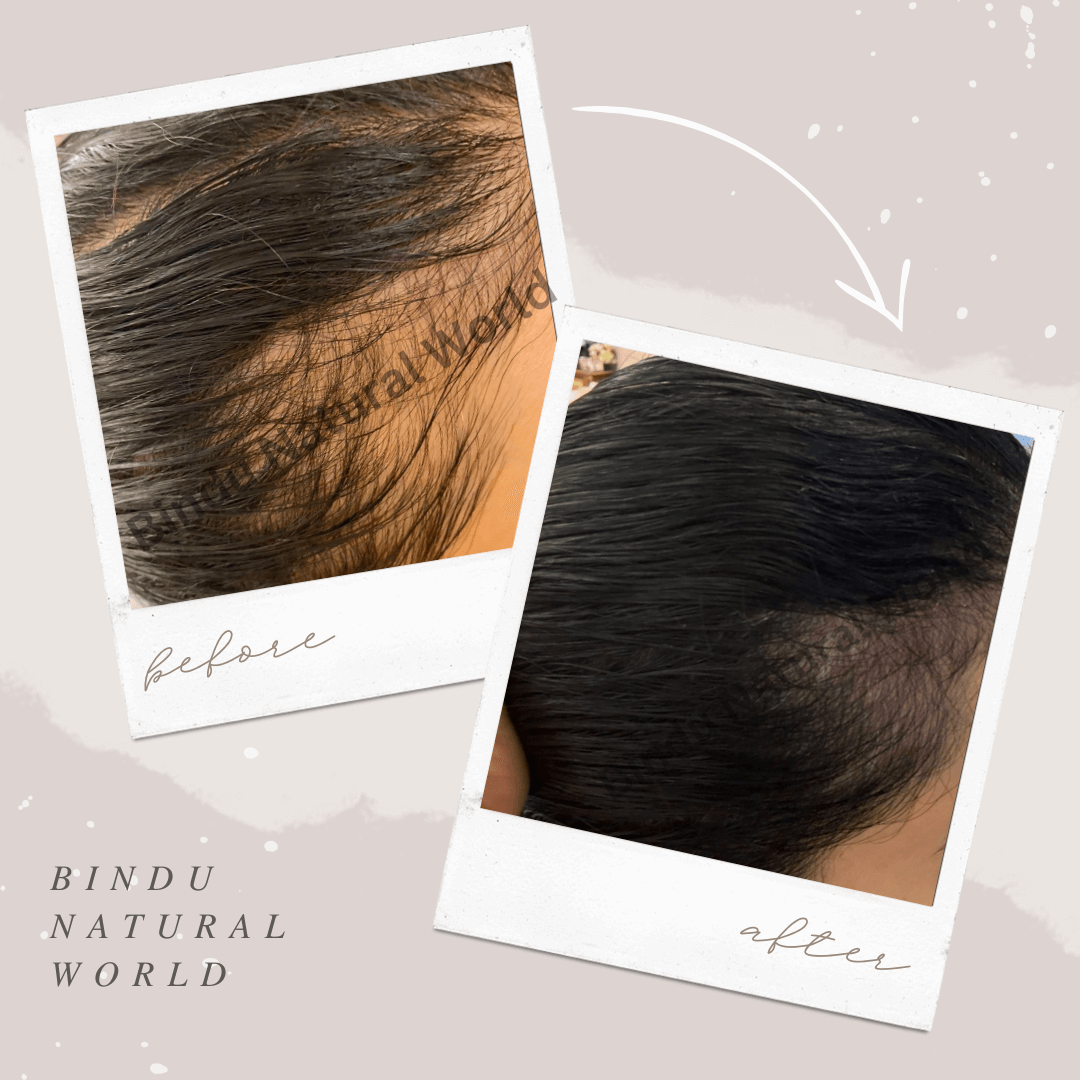 BinduNaturalWorldBeforeandAfter8_c4odc_1080