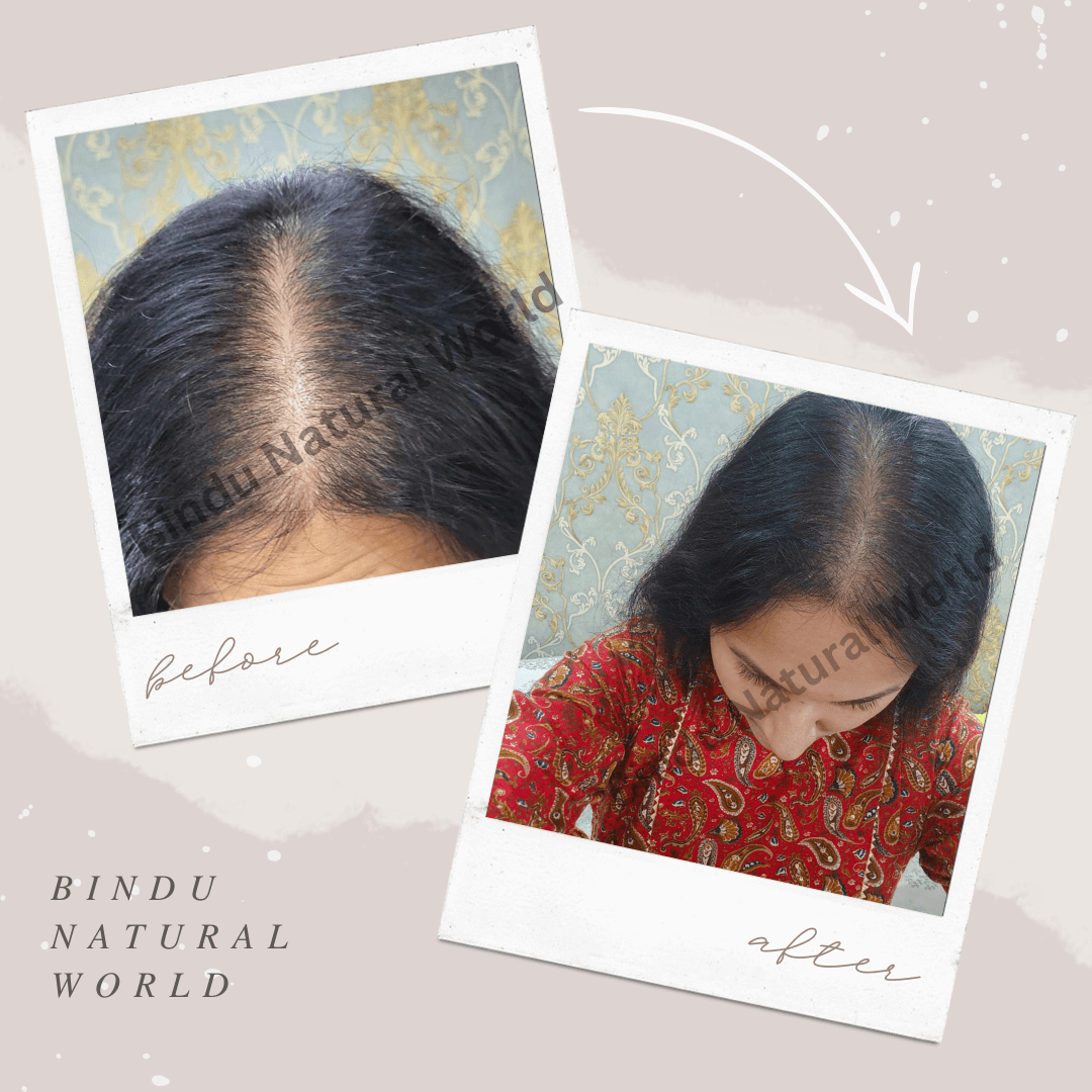 BinduNaturalWorldBeforeandAfter9_aynjc_1080