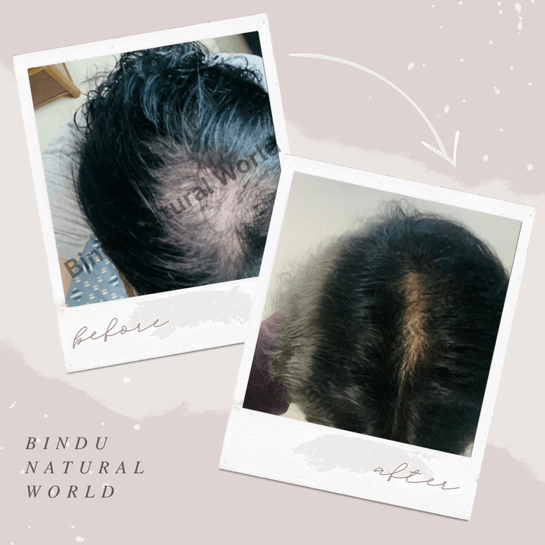 BinduNaturalWorldBeforeandAfter_y5mzg_1080