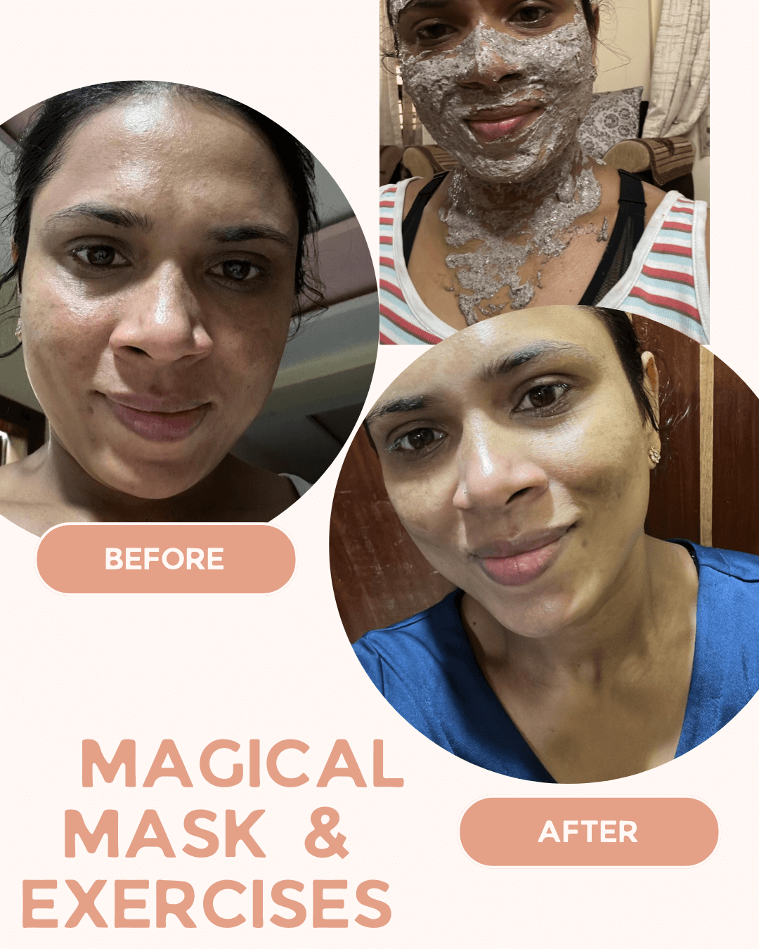 PeachBoldBeautyTreatmentBeforeAfterInstagramPost1_ewmda_1080