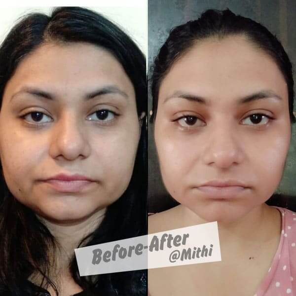 bfraftimgs11_y0nti_600