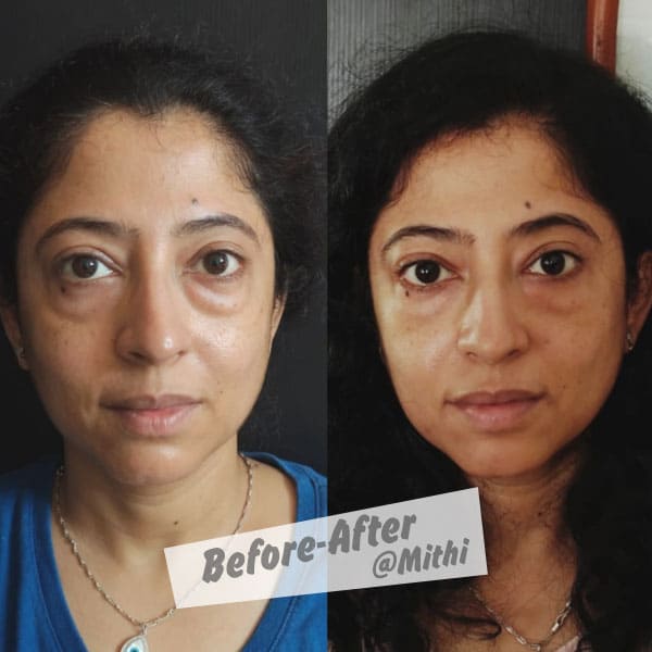 bfraftimgs15_y2mjg_600