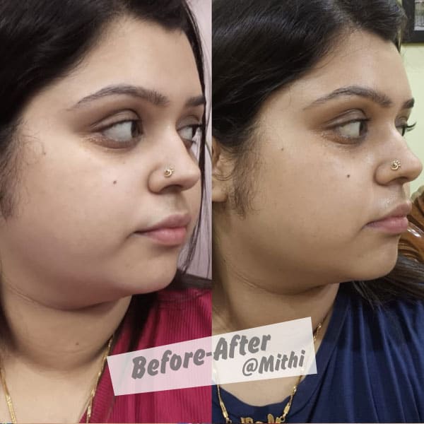 bfraftimgs17_k4mji_600