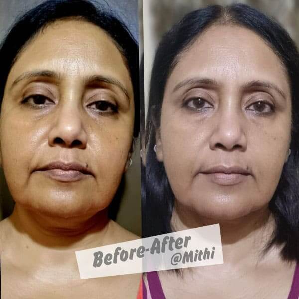 bfraftimgs20_c0odi_600