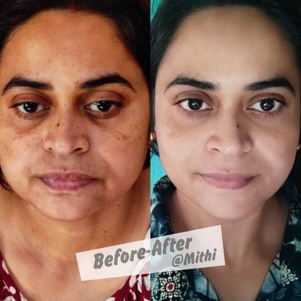 bfraftimgs21_y3mzc_600