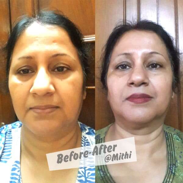 bfraftimgs2_i0nzi_600