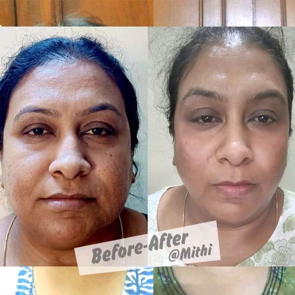 bfraftimgs3_gxndu_600