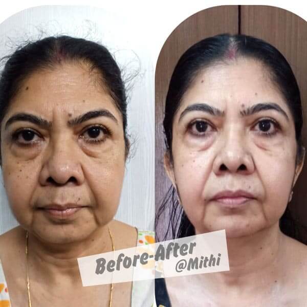 bfraftimgs7_qxodc_600