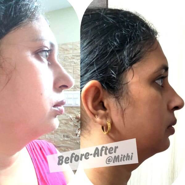 bfraftimgs9_g5mju_600