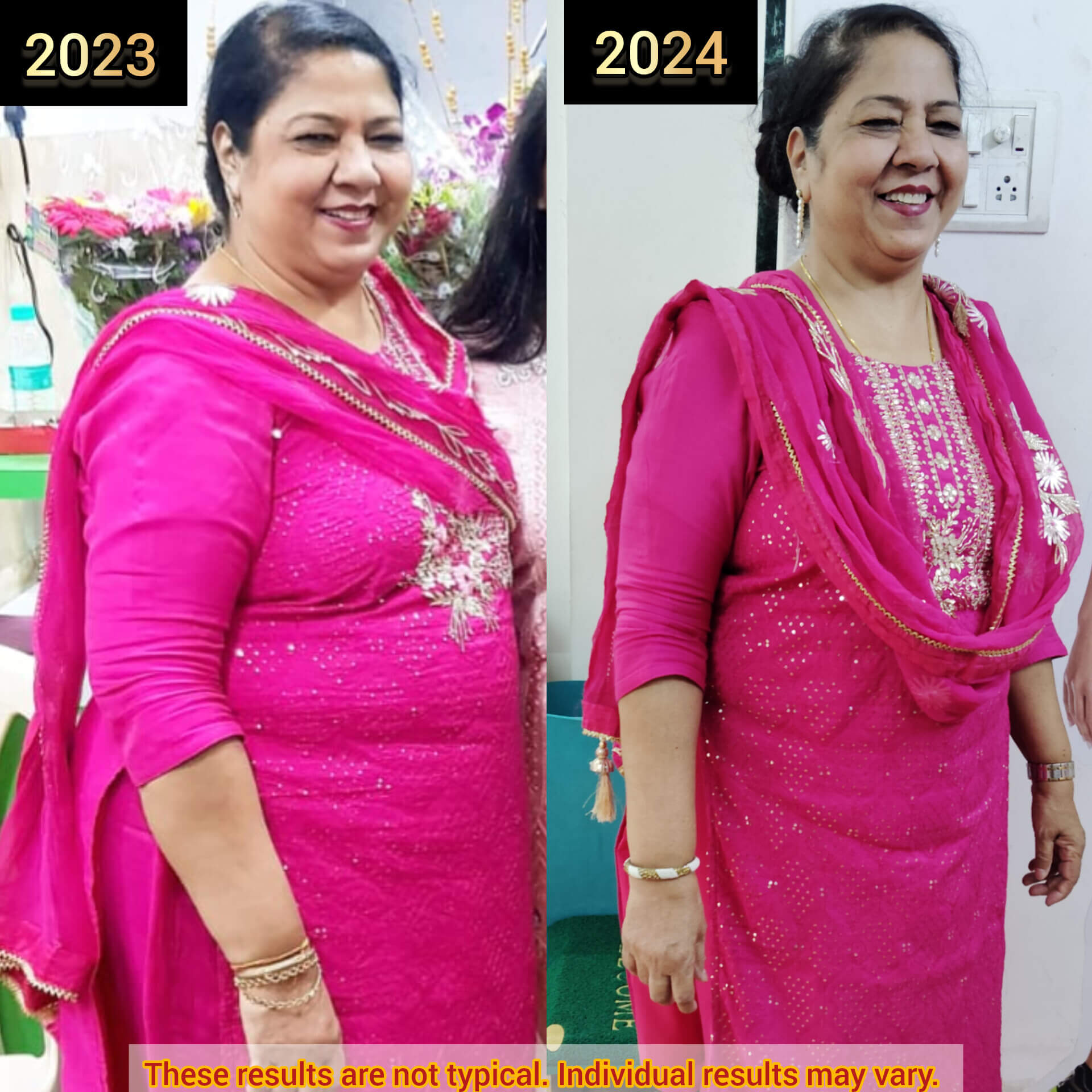 3RaniAgarwalCorporateAge63Severelyobese_cwotk_1920