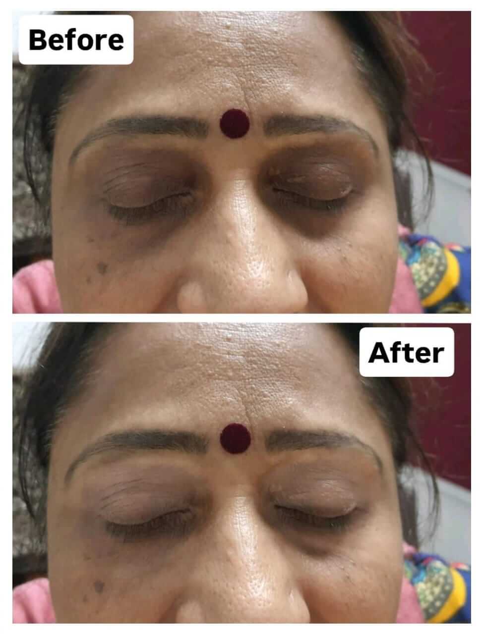 WhatsAppImage20251129at3_m3njq_972