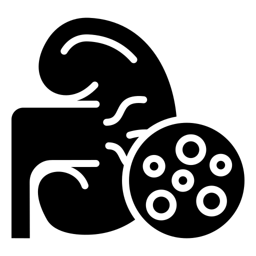 kidneystone_ewndm_512