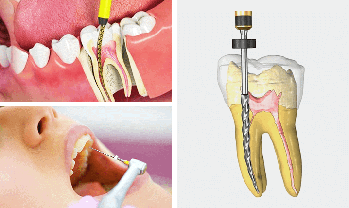endodontist3ashfieldnsw_k5mja_718