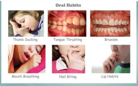 random230304142652f6745ed9thumbnail_iwmzc_475