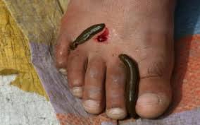 raktamokshan_e1nti_284