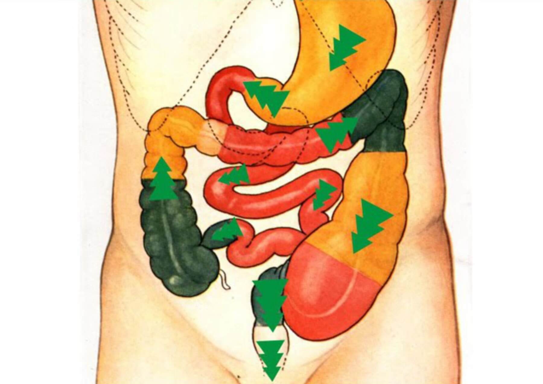 virechana_axntq_1800