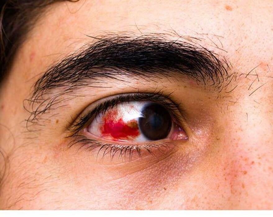 WhatsAppImage20250223at9_kwoty_879