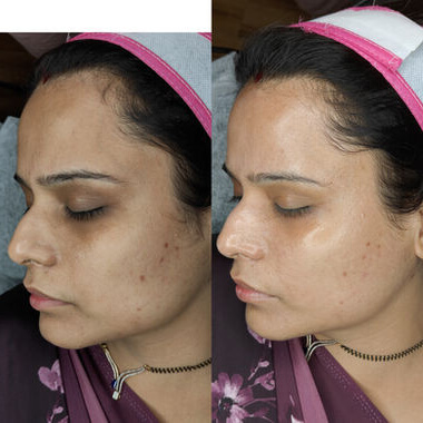 8a0c82994cf6287eb2497dabe0345c644b4e86mv2_mwmdu_380