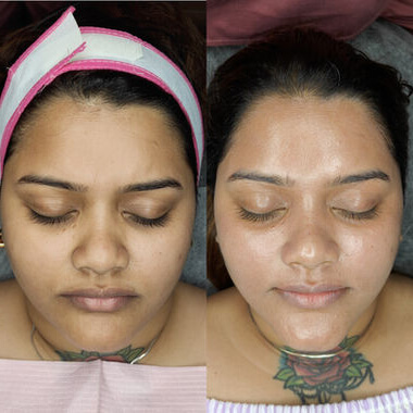 8a0c82bd9519f4733442098b1df2387247eaacmv2_y0oda_380