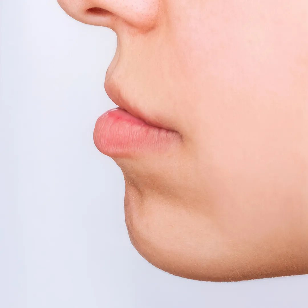 ChinReduction_c3mtq_1080