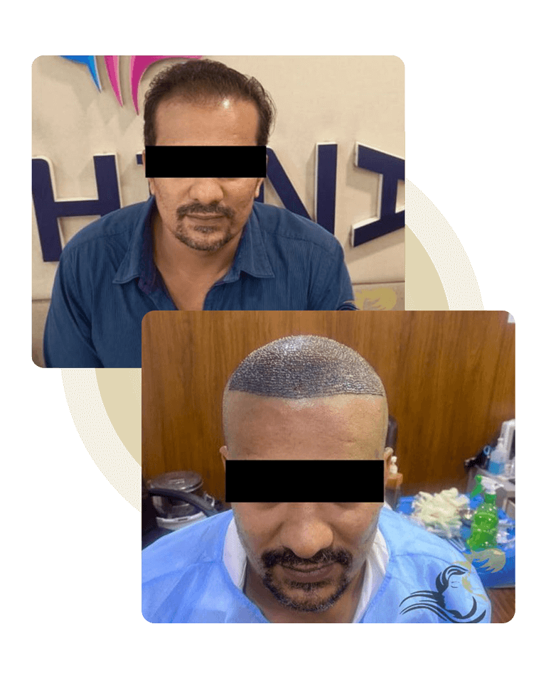 RAJ7851768_yymzm_768