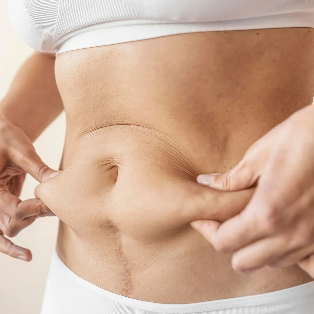 TummyTuck_m4odi_1080