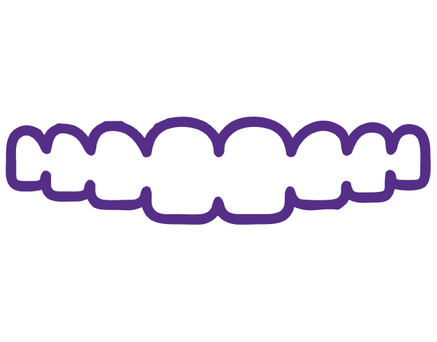aligners_hghpv_626