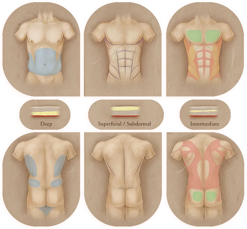 contouring1_i1mdu_786