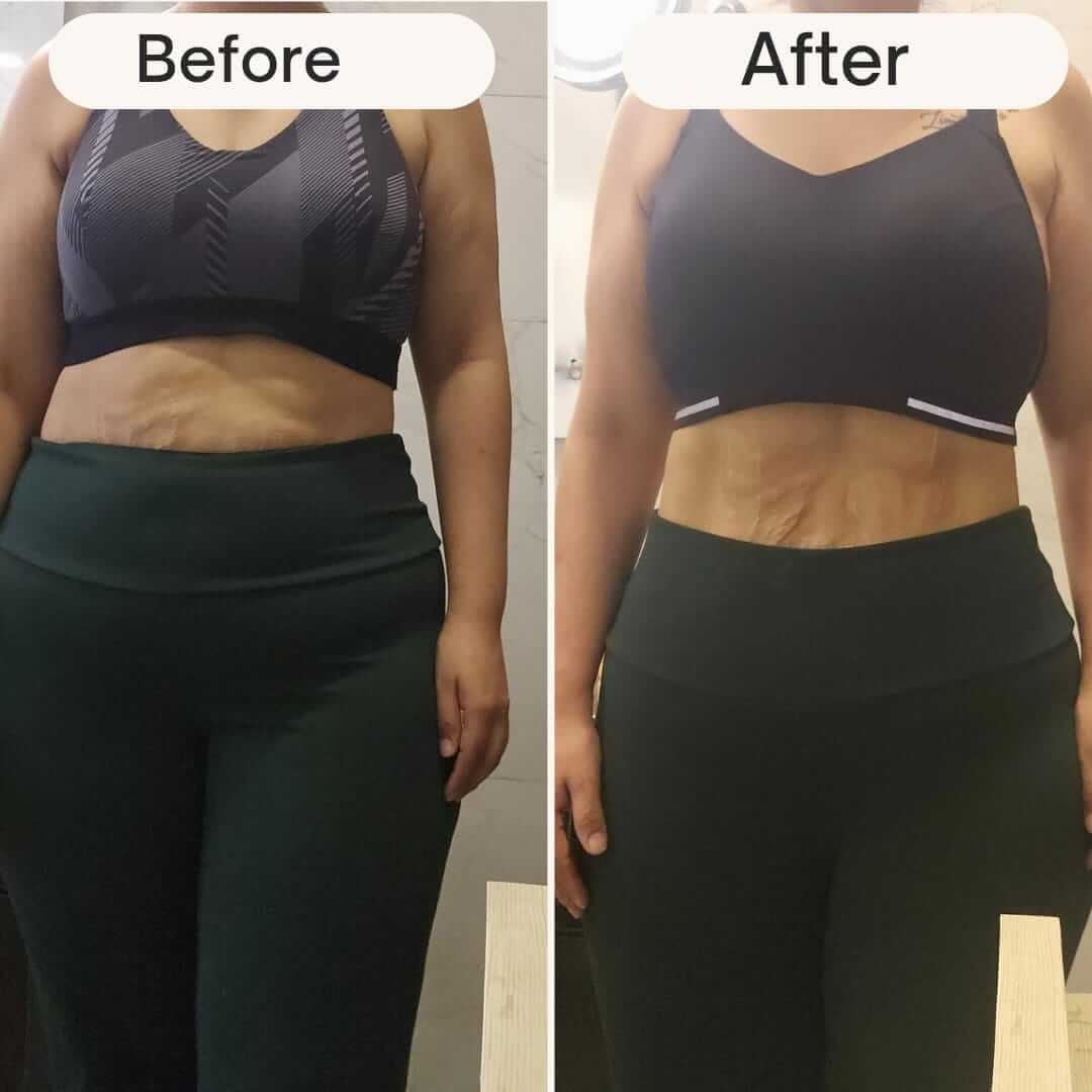 BeforeAfter_p63cv_1080