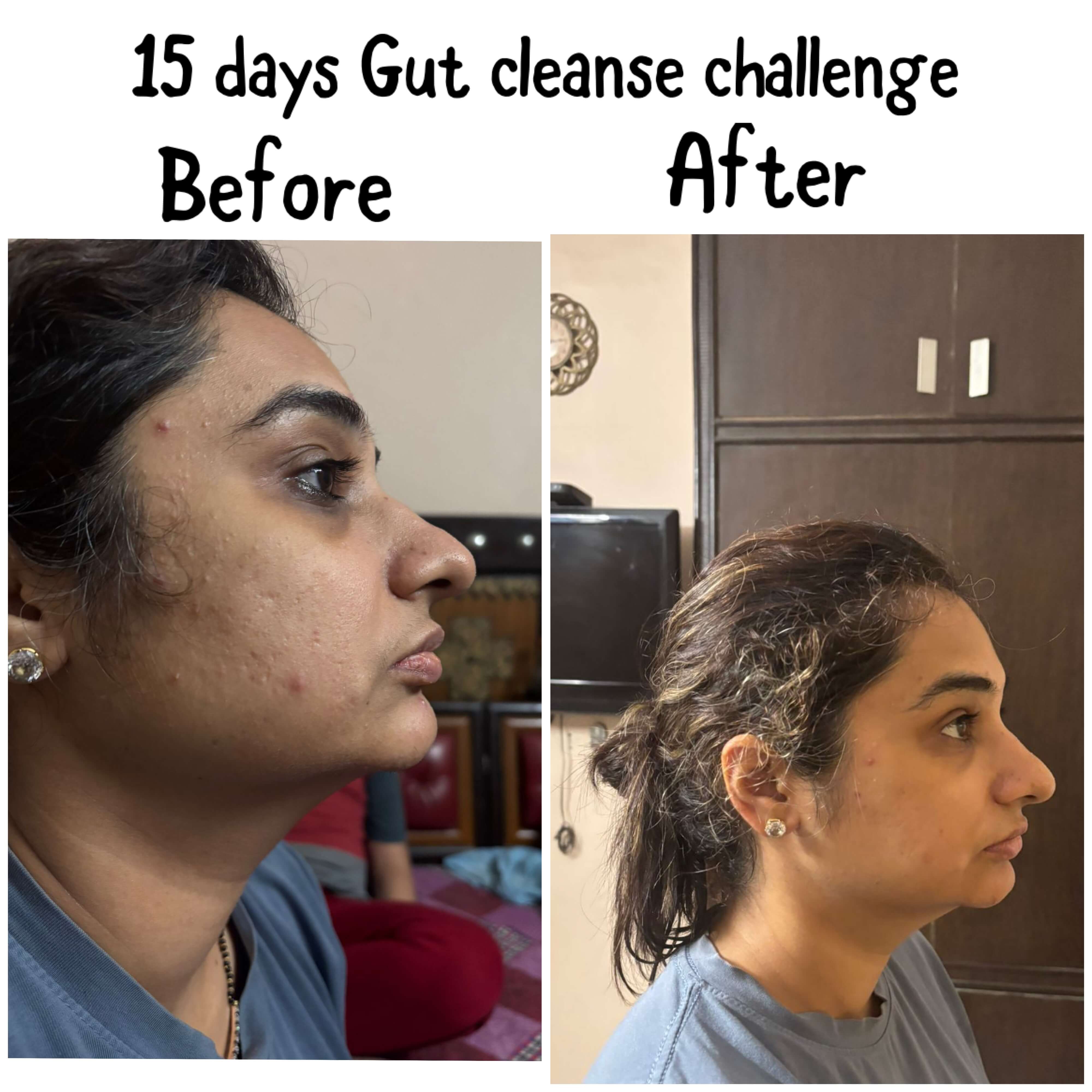 BeforeandAfter_wmt5f_4000