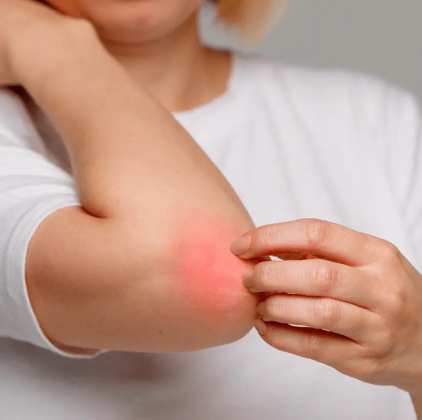 treatmentforitchingatgangasheelhospitalbareilly_i0mti_824