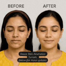 BlackWhiteSimpleComingSoonInstagramPostSquare1_q3mjc_216