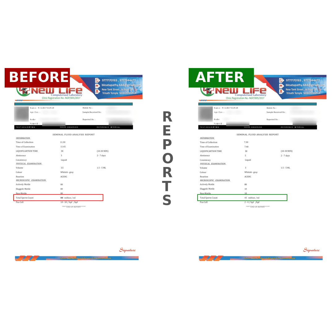 AJEETKUMARBeforeAfter_0momt_1080