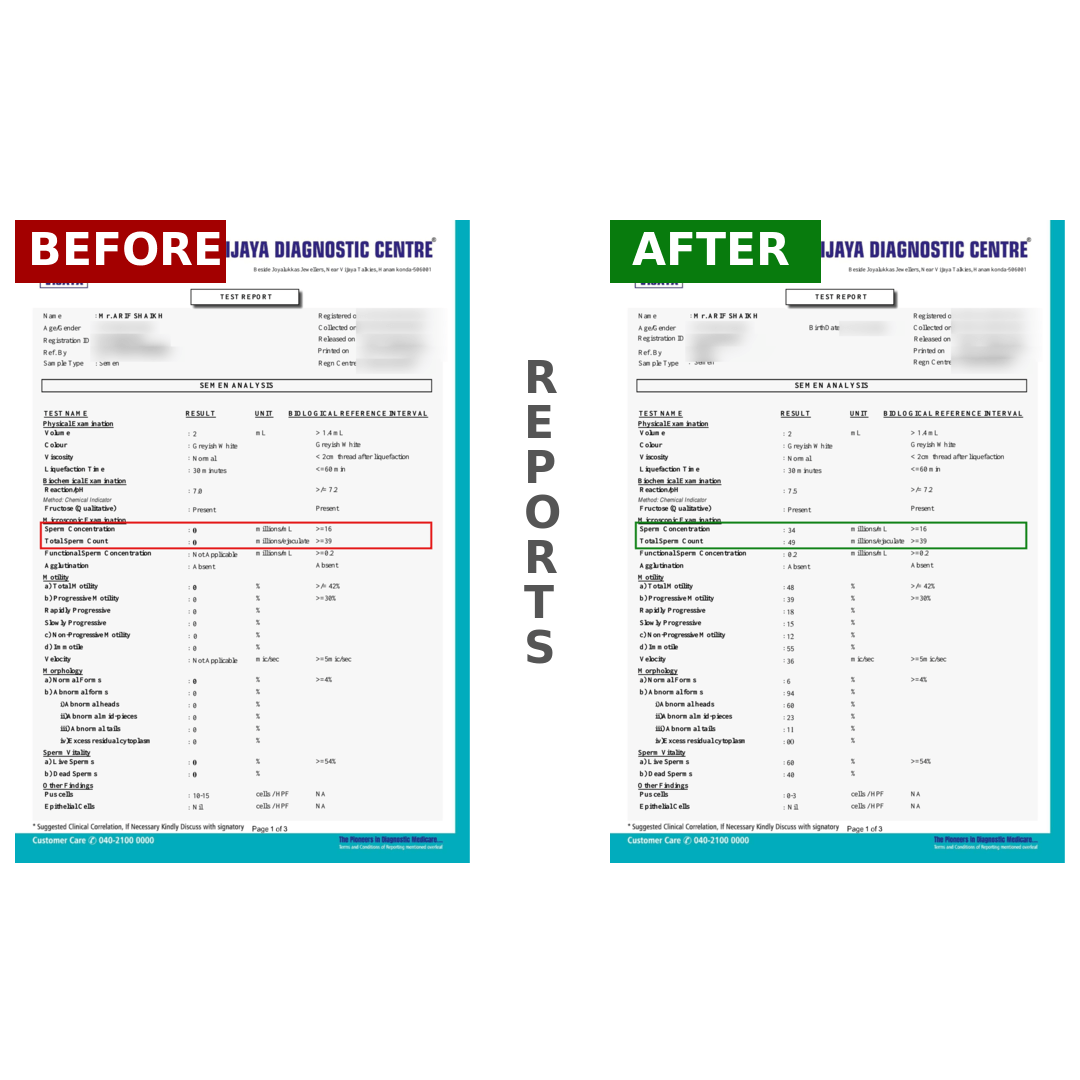 ARIFSHAIKHBeforeAfter_qlfey_1080