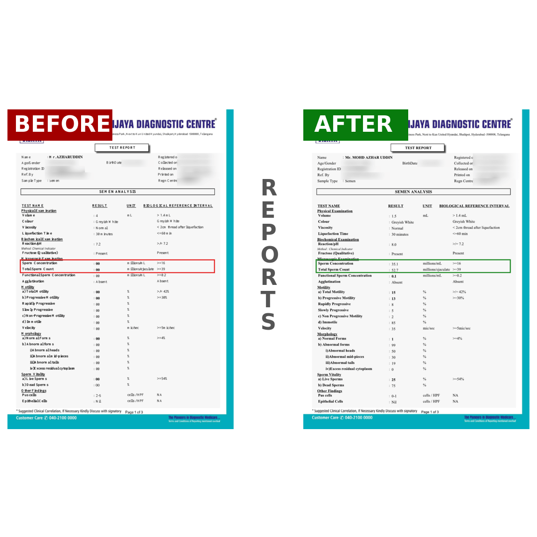 AZHARUDDINBeforeAfter_ex94k_1080