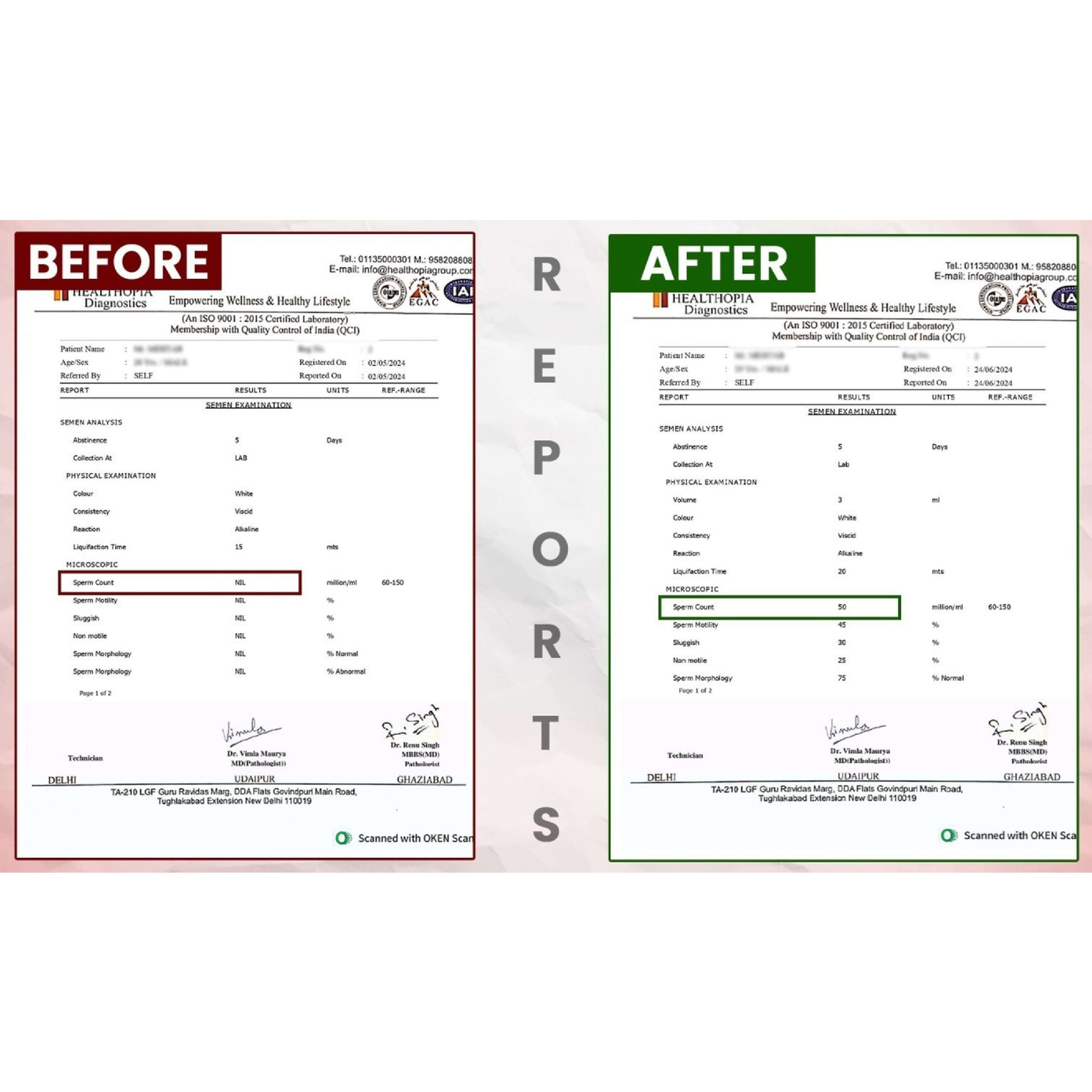 BeforeAfterfortasleenpagesimages0_acabf_3375