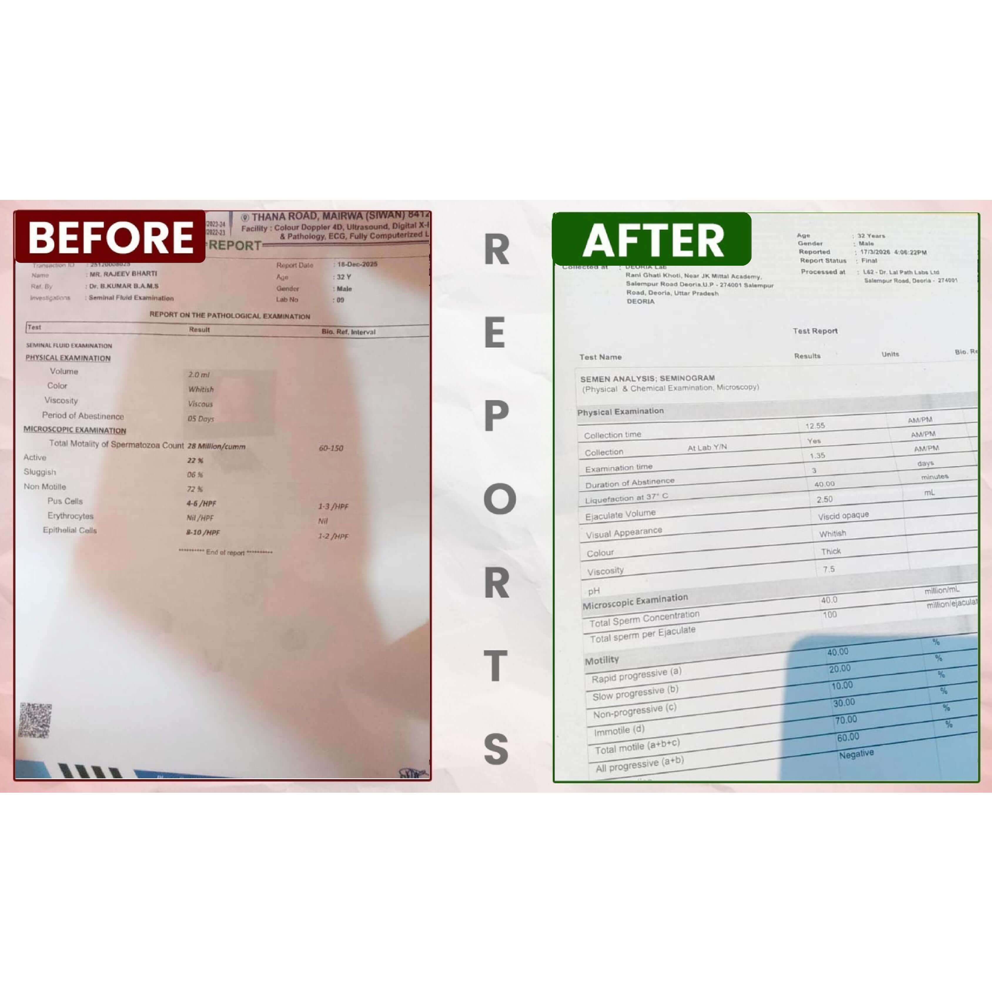 BeforeAfterfortasleenpagesimages11_bg93a_3375