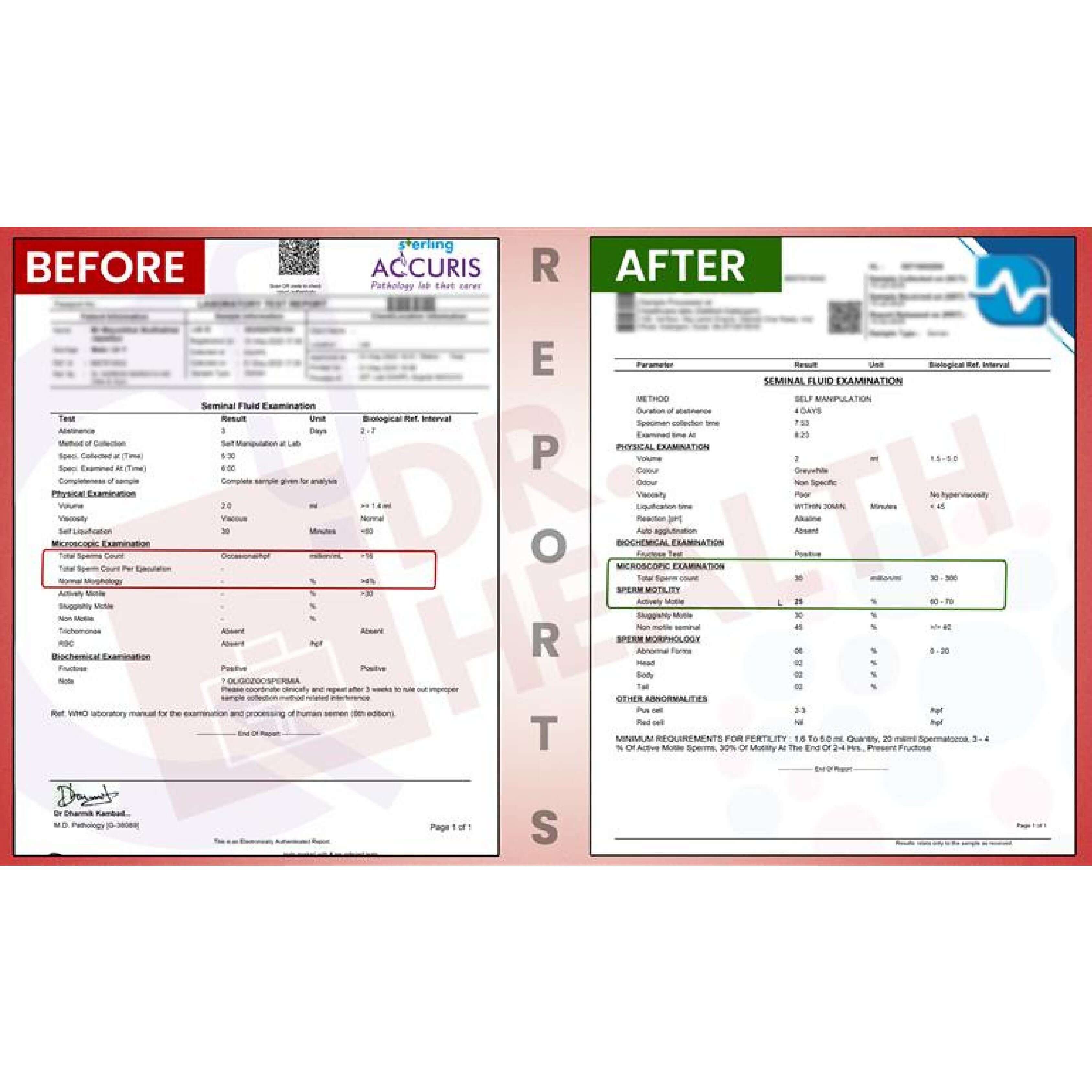 BeforeAfterfortasleenpagesimages1_lra3t_3375