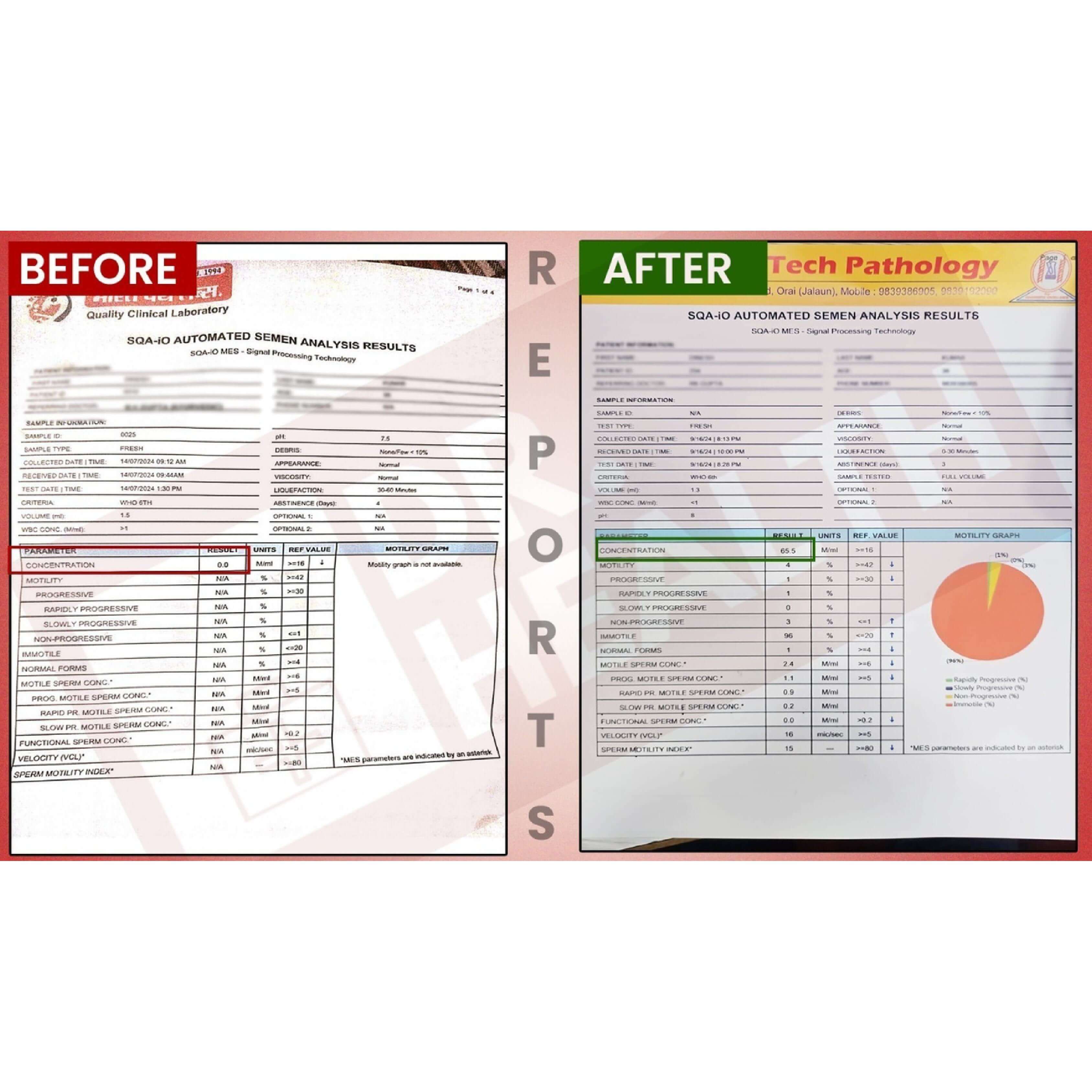 BeforeAfterfortasleenpagesimages3_i8ny8_3375